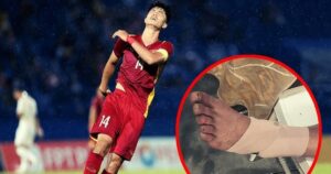 U23 Việt Nam đối mặt khó khăn khi Nguyễn Văn Trường chấn thương